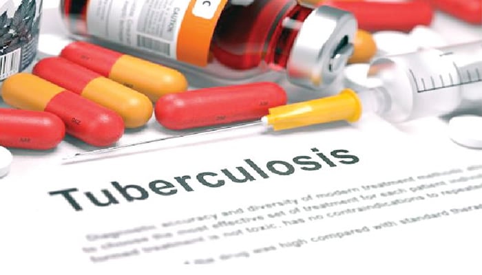 TUBERCULOSIS